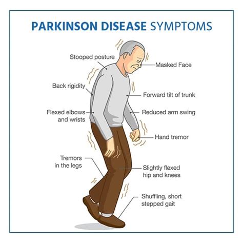 what is parkinson's disease with dyskinesia